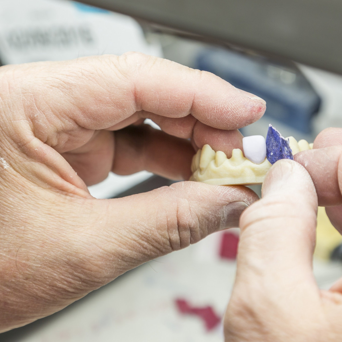 Prosthodontics And Restorative Dentisty